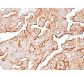 Immunohistochemistry - Anti-MUC16 Antibody [OCA125/1900] (A250624) - Antibodies.com