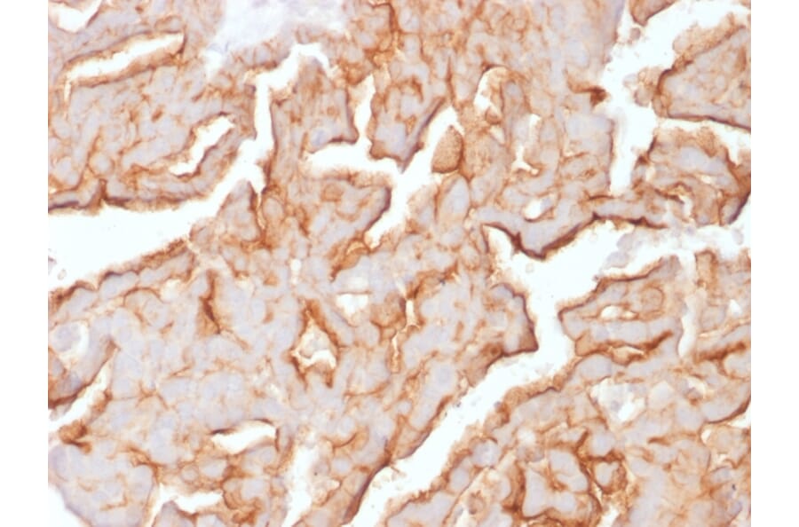 Immunohistochemistry - Anti-MUC16 Antibody [OCA125/1900] (A250624) - Antibodies.com
