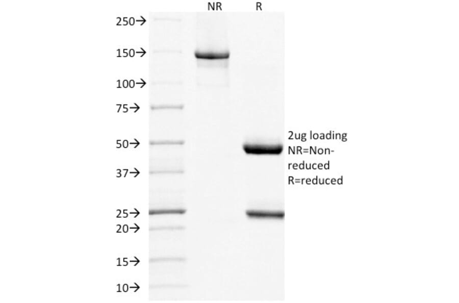 SDS-PAGE - Anti-MUC16 Antibody [OCA125/1900] (A250625) - Antibodies.com