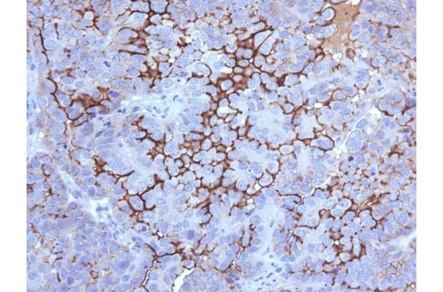Immunohistochemistry - Anti-MUC16 Antibody [5E11] (A250625) - Antibodies.com