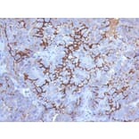 Immunohistochemistry - Anti-MUC16 Antibody [5E11] (A250625) - Antibodies.com