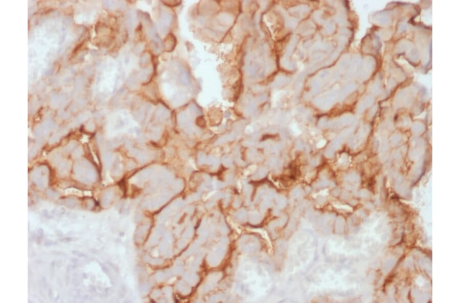 Immunohistochemistry - Anti-MUC16 Antibody [OCA125/2349R] (A250627) - Antibodies.com