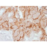 Immunohistochemistry - Anti-MUC16 Antibody [OCA125/2349R] (A250627) - Antibodies.com