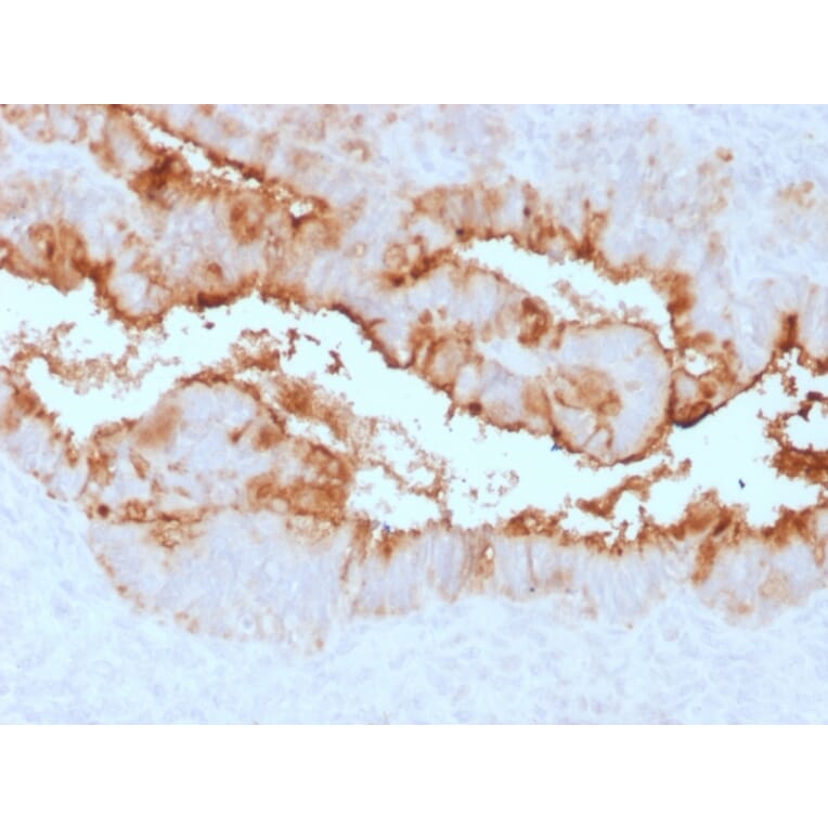 Immunohistochemistry - Anti-MUC16 Antibody [OCA125/2349R] (A250626) - Antibodies.com