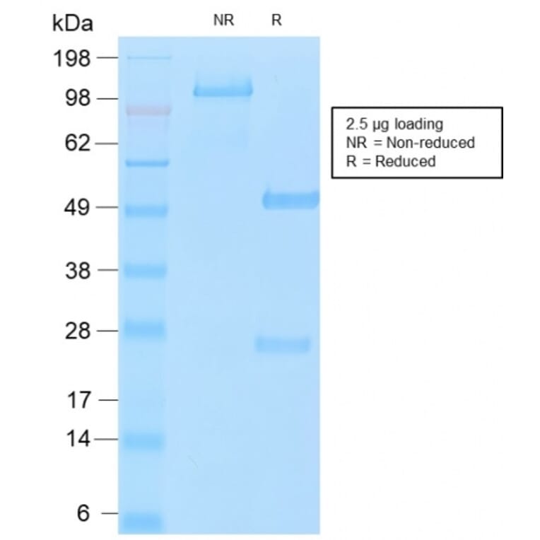 SDS-PAGE - Anti-MUC16 Antibody [OCA125/2349R] (A250627) - Antibodies.com