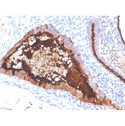 Immunohistochemistry - Anti-MUC16 Antibody [OCA125/4505R] (A250628) - Antibodies.com