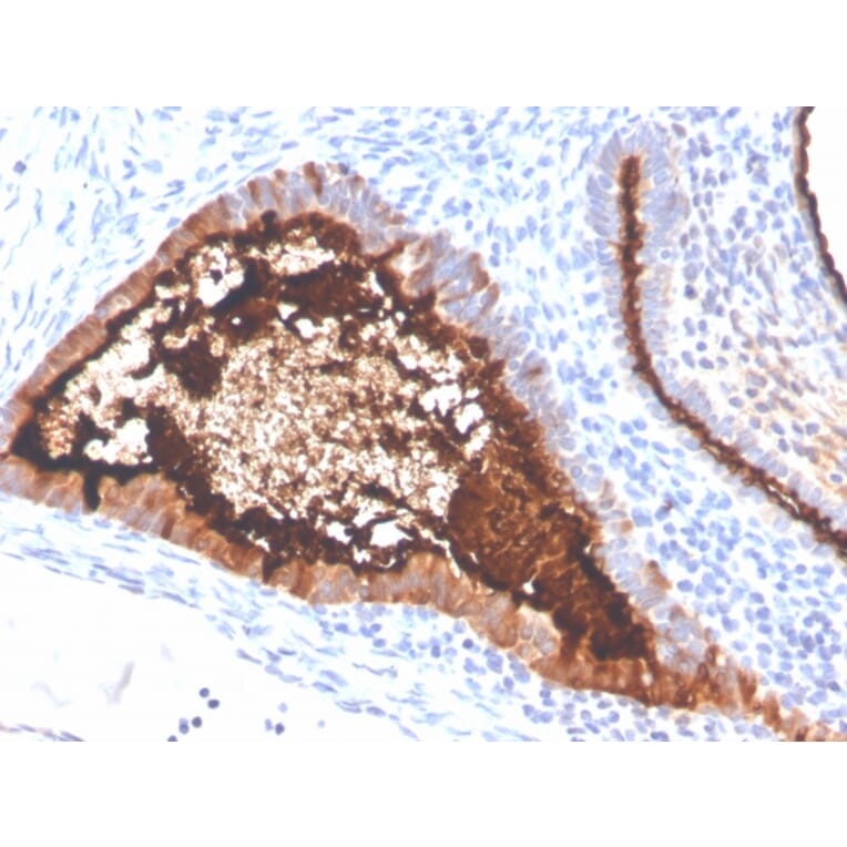 Immunohistochemistry - Anti-MUC16 Antibody [OCA125/4505R] (A250628) - Antibodies.com