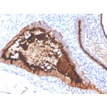 Immunohistochemistry - Anti-MUC16 Antibody [OCA125/4505R] (A250628) - Antibodies.com