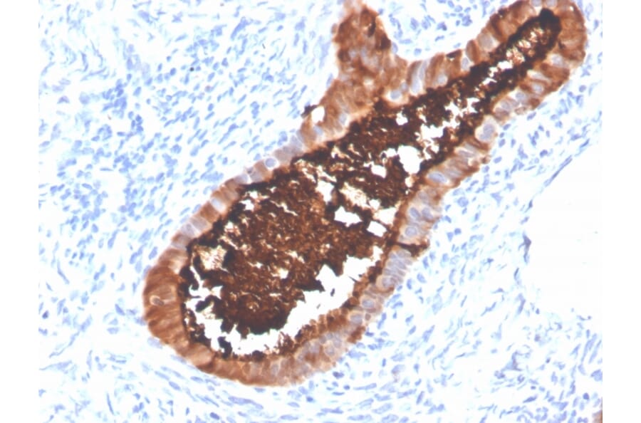 Immunohistochemistry - Anti-MUC16 Antibody [OCA125/4505R] (A250627) - Antibodies.com