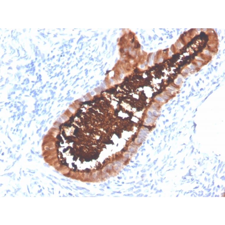 Immunohistochemistry - Anti-MUC16 Antibody [OCA125/4505R] (A250627) - Antibodies.com