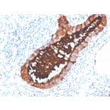 Immunohistochemistry - Anti-MUC16 Antibody [OCA125/4505R] (A250627) - Antibodies.com