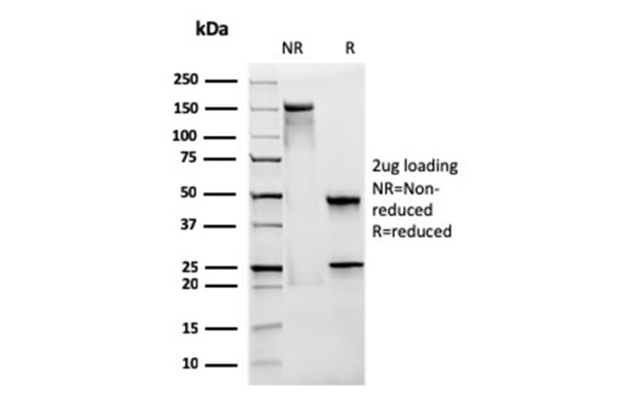 SDS-PAGE - Anti-CD28 Antibody [CB28] (A250629) - Antibodies.com