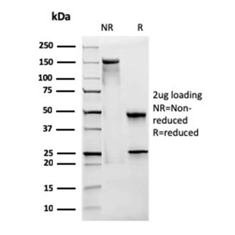 SDS-PAGE - Anti-CD28 Antibody [CB28] (A250629) - Antibodies.com