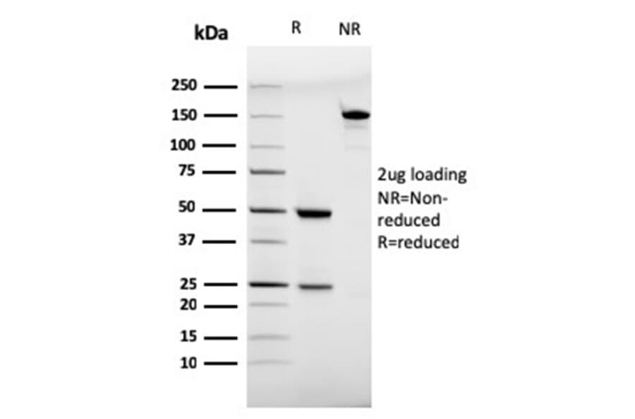 SDS-PAGE - Anti-CD28 Antibody [C28/75] (A250630) - Antibodies.com