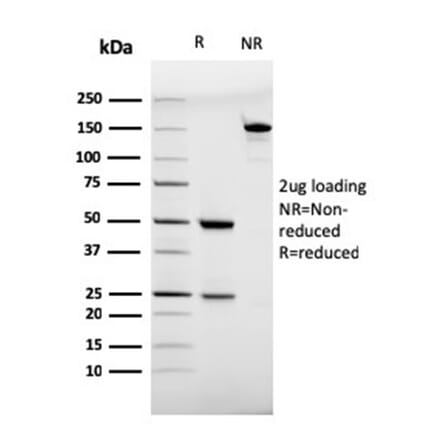 SDS-PAGE - Anti-CD28 Antibody [C28/75] (A250630) - Antibodies.com