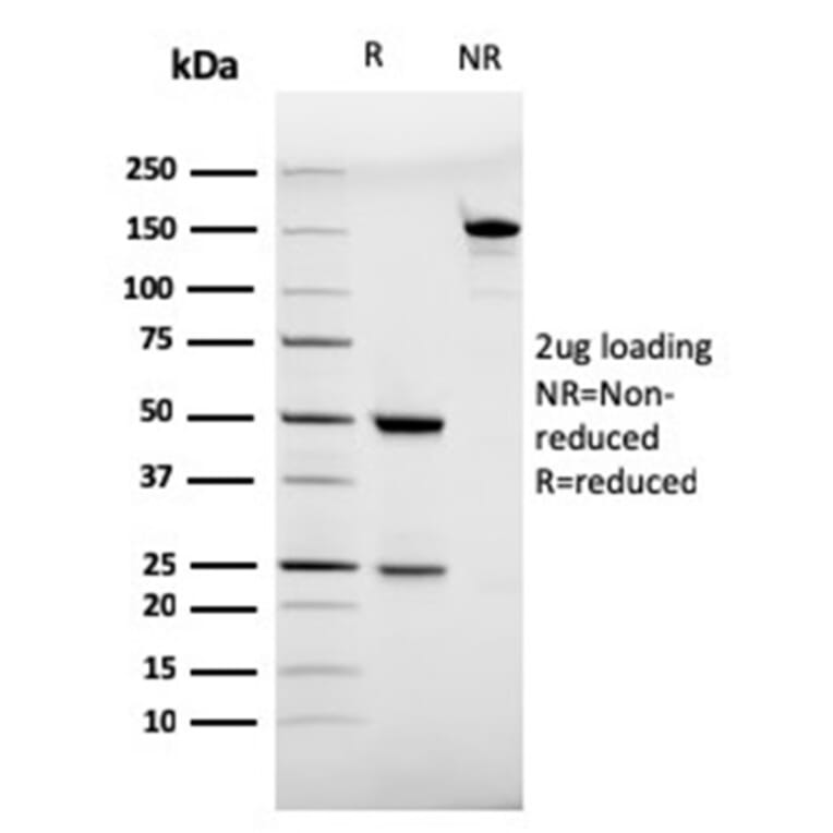 SDS-PAGE - Anti-CD28 Antibody [C28/75] (A250630) - Antibodies.com