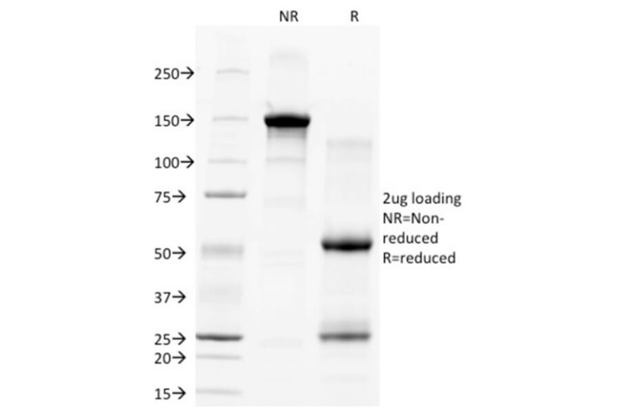 SDS-PAGE - Anti-CD28 Antibody [C28/77] (A250630) - Antibodies.com