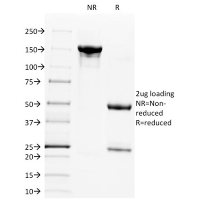 SDS-PAGE - Anti-CD28 Antibody [C28/1636] (A250633) - Antibodies.com