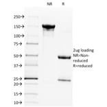 SDS-PAGE - Anti-CD28 Antibody [C28/1636] (A250633) - Antibodies.com