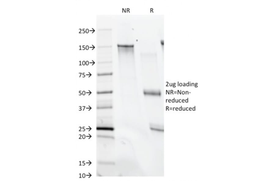 SDS-PAGE - Anti-CD28 Antibody [C28/74] (A250633) - Antibodies.com