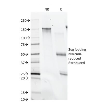 SDS-PAGE - Anti-CD28 Antibody [C28/74] (A250633) - Antibodies.com