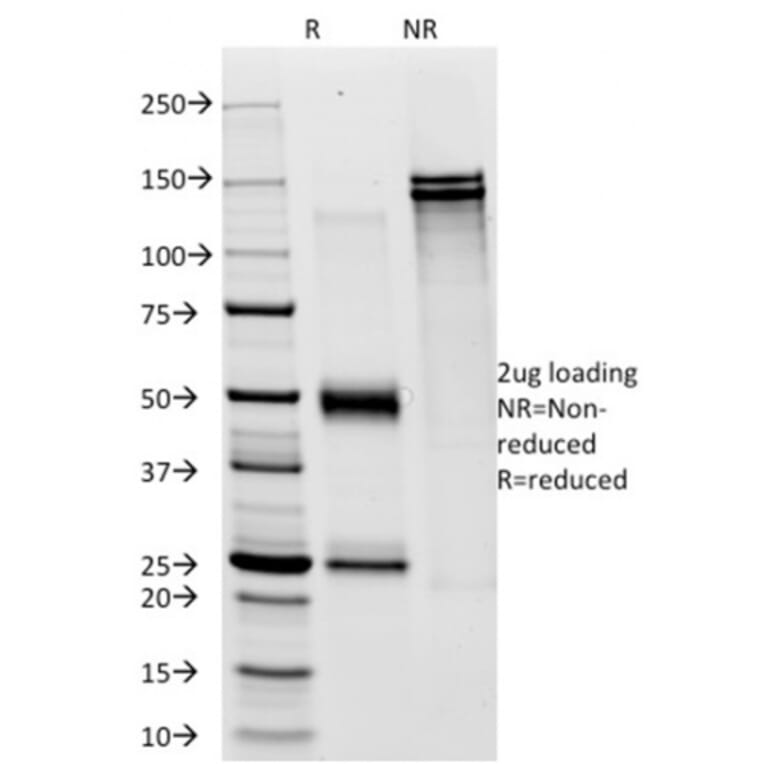 SDS-PAGE - Anti-CD28 Antibody [C28/76] (A250635) - Antibodies.com