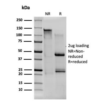 SDS-PAGE - Anti-CD80 Antibody [C80/1608] (A250635) - Antibodies.com