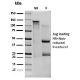 SDS-PAGE - Anti-CD80 Antibody [C80/1608] (A250635) - Antibodies.com