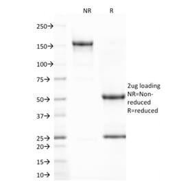 SDS-PAGE - Anti-CD80 Antibody [C80/2723] (A250637) - Antibodies.com