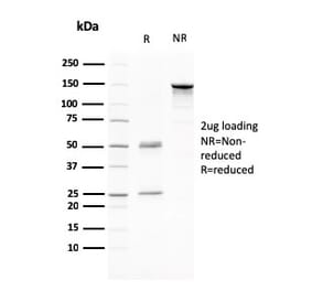 SDS-PAGE - Anti-CD80 Antibody [C80/2776] (A250639) - Antibodies.com