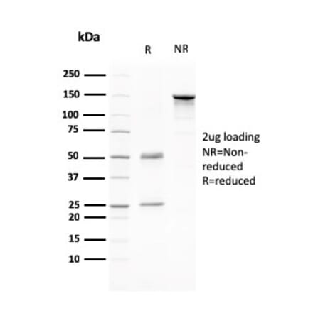 SDS-PAGE - Anti-CD80 Antibody [C80/2776] (A250639) - Antibodies.com