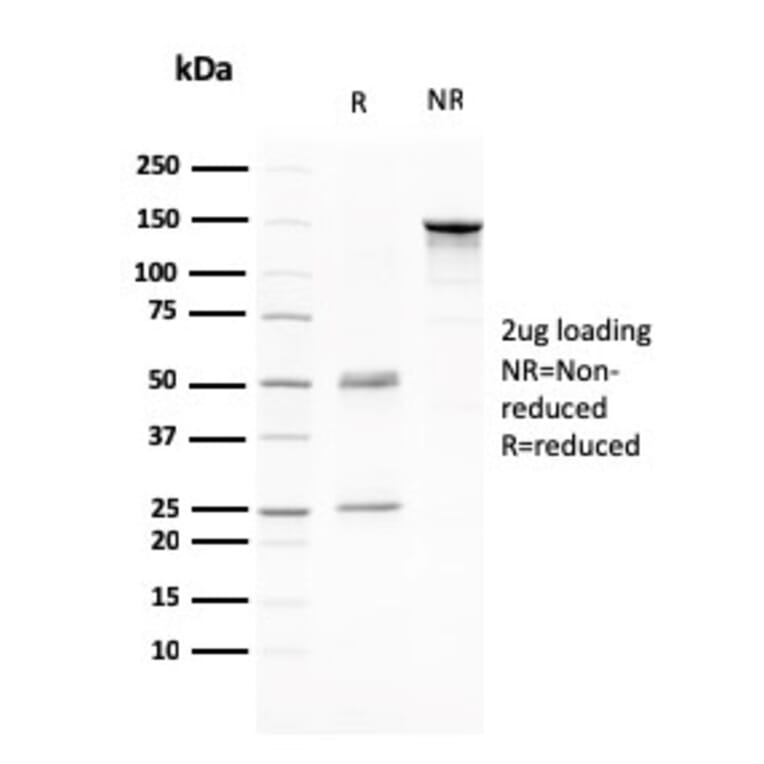 SDS-PAGE - Anti-CD80 Antibody [C80/2776] (A250639) - Antibodies.com