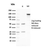 SDS-PAGE - Anti-CD80 Antibody [C80/2776] (A250639) - Antibodies.com