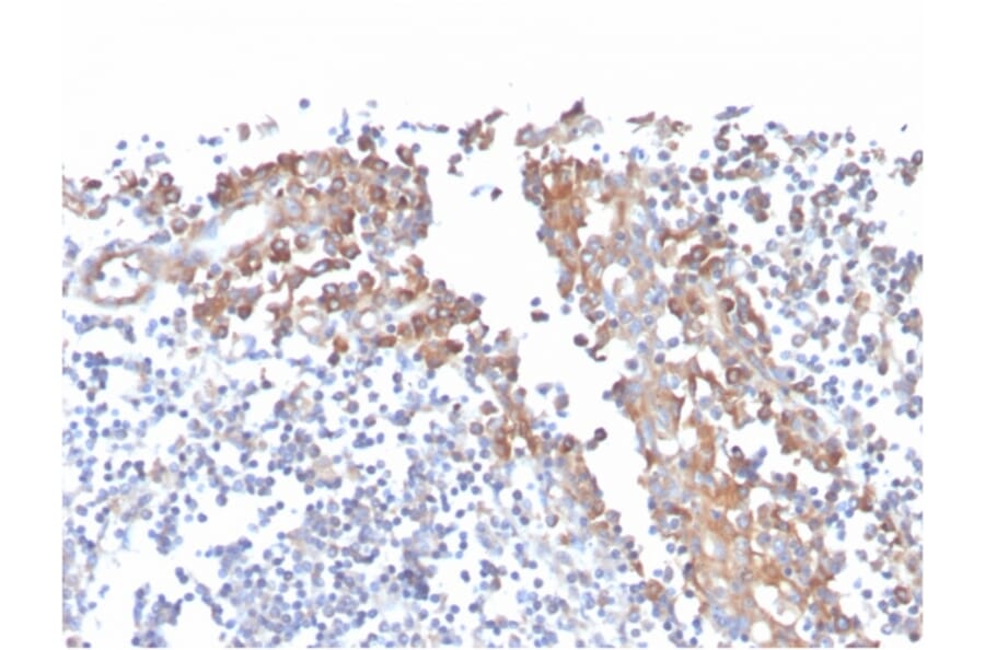 Immunohistochemistry - Anti-CD80 Antibody [C80/3544] (A250640) - Antibodies.com