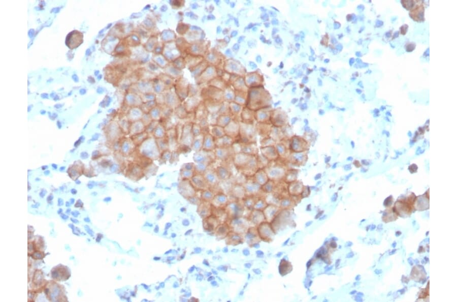 Immunohistochemistry - Anti-CD86 Antibody [C86/3711] (A250641) - Antibodies.com
