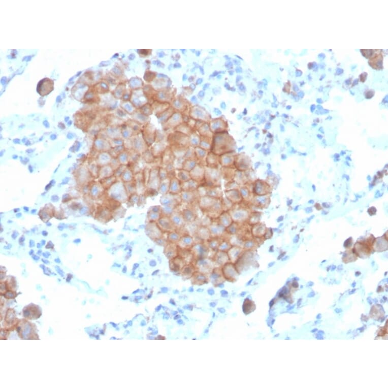 Immunohistochemistry - Anti-CD86 Antibody [C86/3711] (A250641) - Antibodies.com