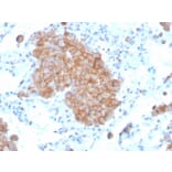Immunohistochemistry - Anti-CD86 Antibody [C86/3711] (A250641) - Antibodies.com
