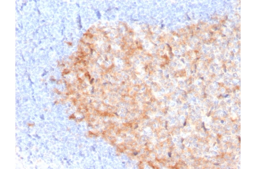 Immunohistochemistry - Anti-CD86 Antibody [C86/3713] (A250641) - Antibodies.com