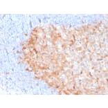 Immunohistochemistry - Anti-CD86 Antibody [C86/3713] (A250641) - Antibodies.com