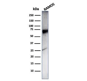 Western Blot - Anti-CD86 Antibody [C86/3716] (A250643) - Antibodies.com
