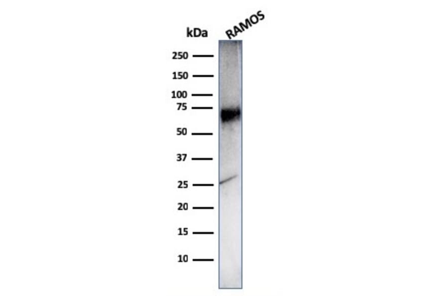 Western Blot - Anti-CD86 Antibody [C86/3716] (A250643) - Antibodies.com