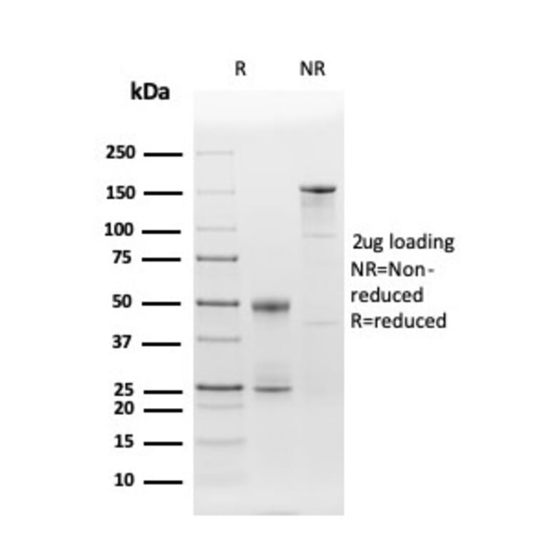 SDS-PAGE - Anti-CD86 Antibody [C86/3716] (A250643) - Antibodies.com
