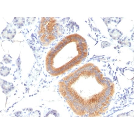 Immunohistochemistry - Anti-CD86 Antibody [C86/1146] (A250645) - Antibodies.com