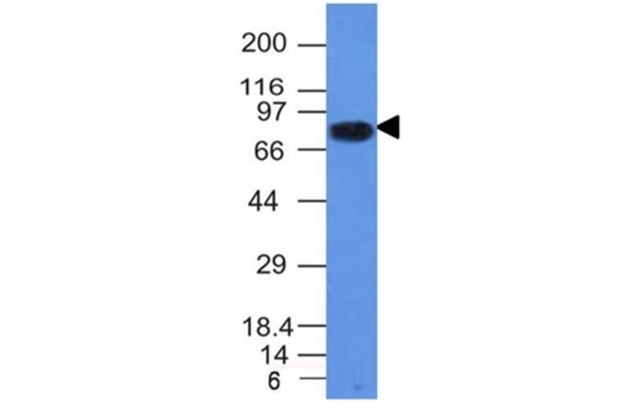 Western Blot - Anti-CD86 Antibody [C86/1146] (A250645) - Antibodies.com