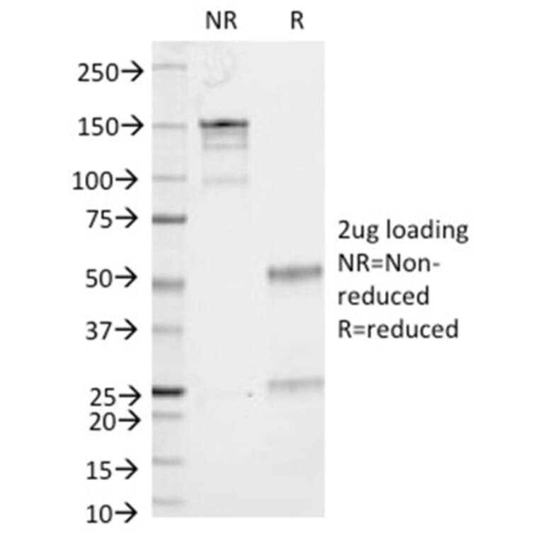 SDS-PAGE - Anti-CD86 Antibody [C86/1146] (A250645) - Antibodies.com