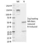 SDS-PAGE - Anti-CD86 Antibody [C86/1146] (A250645) - Antibodies.com