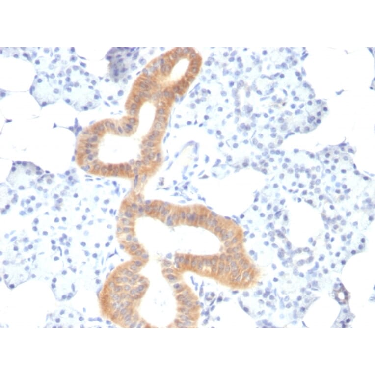 Immunohistochemistry - Anti-CD86 Antibody [SPM600] (A250646) - Antibodies.com