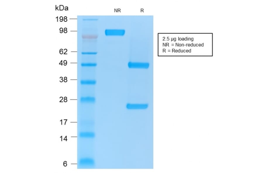 SDS-PAGE - Anti-CD86 Antibody [rC86/1146] (A250647) - Antibodies.com