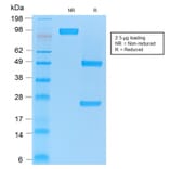 SDS-PAGE - Anti-CD86 Antibody [rC86/1146] (A250647) - Antibodies.com