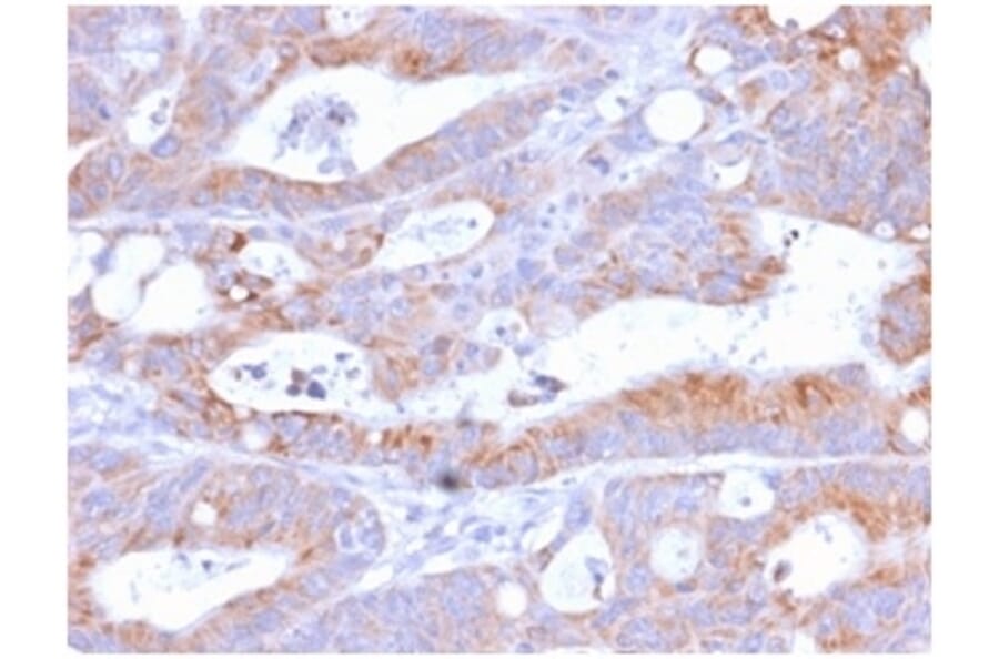 Immunohistochemistry - Anti-NULL Antibody [C86/2160R] (A250648) - Antibodies.com
